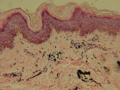 How does skin retain&nbsp;ink?