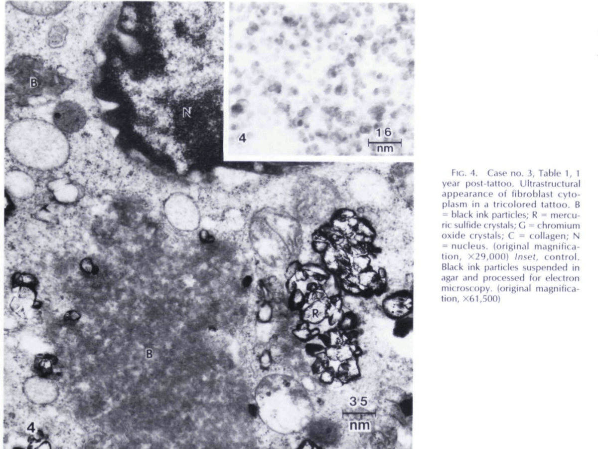 How do colour tattoos&nbsp;work?